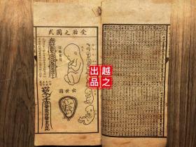 这3种汤尽量别给孩子喝了能够对娃的脾胃发作很大影响别看不起