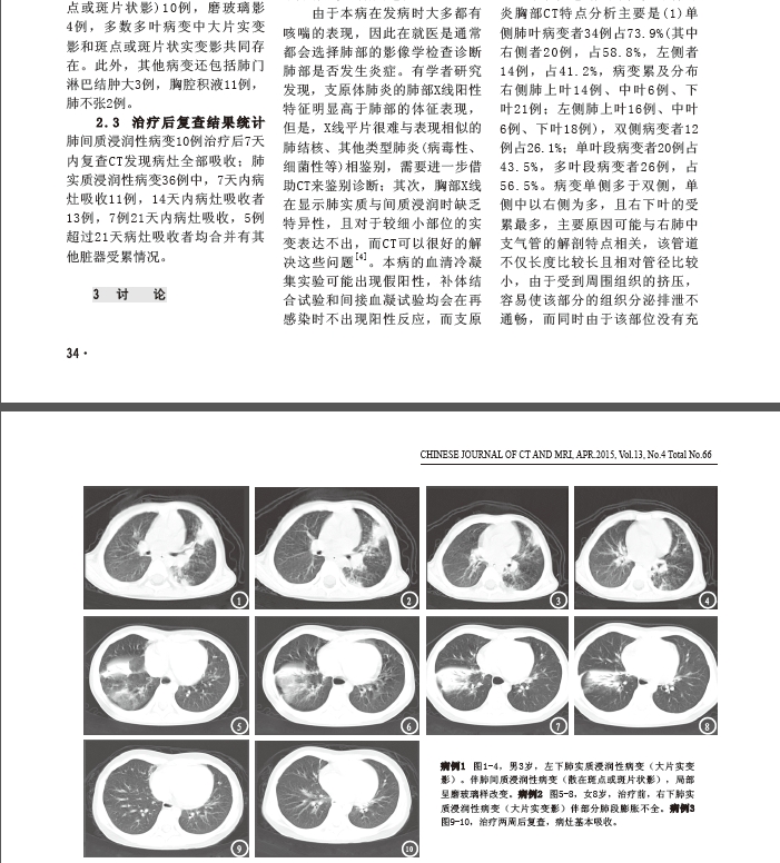 津城陌头涂鸦画路人受惊吓选对位置是枢纽